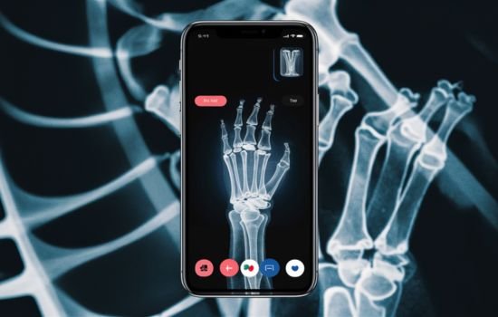 Aplicación de Rayos X por Celular Gratuita